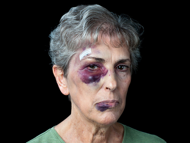 Beaten old woman